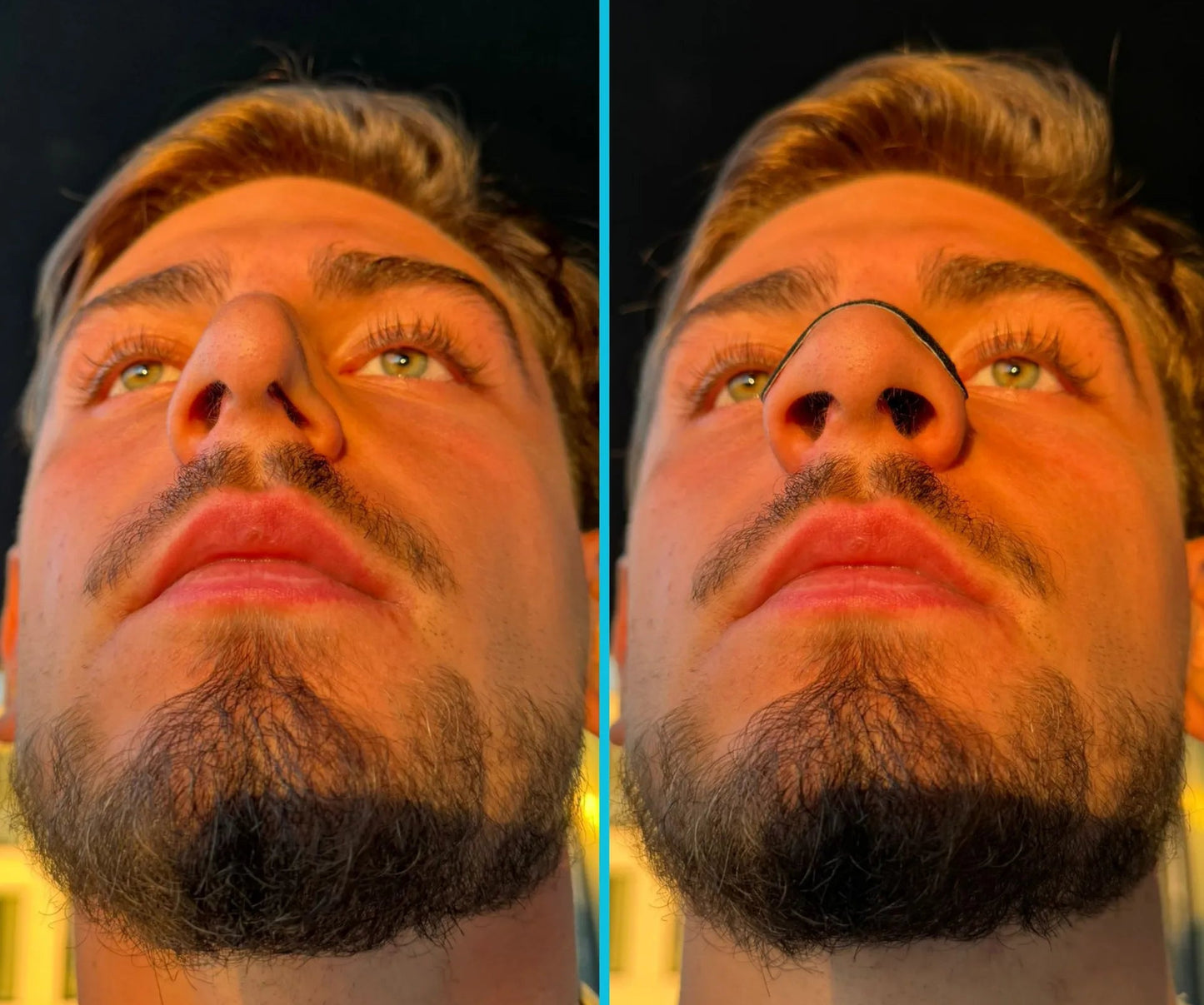 Before and after for using the Respiro Nose Strip (showing the benefits)